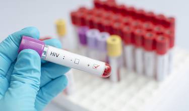 Neue Behandlungsmöglichkeit gegen HIV