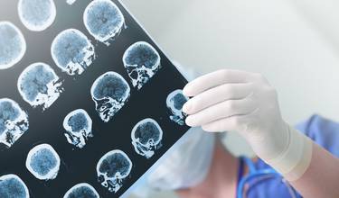 Unprecedented chemical compound prevents epilepsy