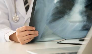 Ny metod upptäcker nästan alla cancerformer