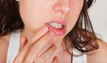 New way of treating herpes infections