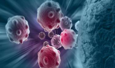 Nanopartikler dræber kræftceller på usædvanlig vis