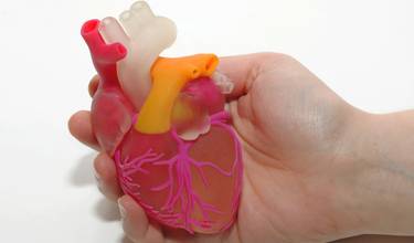 Atrial Fibrillation