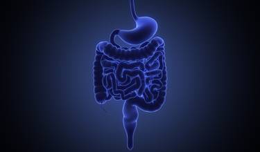Irritable Bowel Syndrome (IBS)